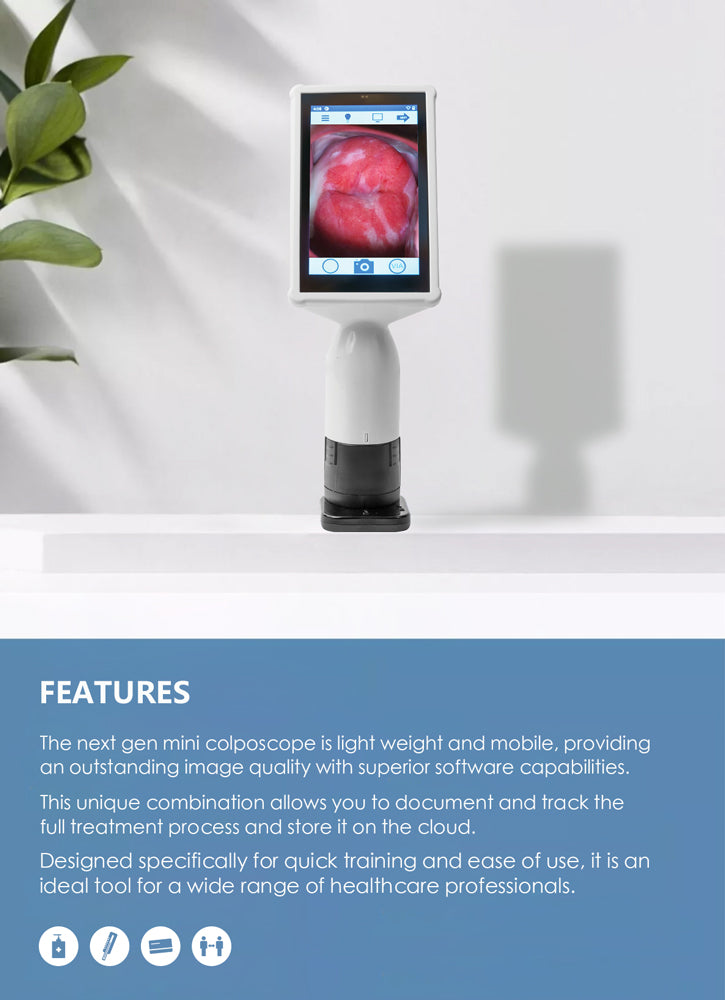 Enhanced Diagnosis: Handheld Big Screen Gynecological Colposcopy Video Colposcope | Your Trusted Medical Tool