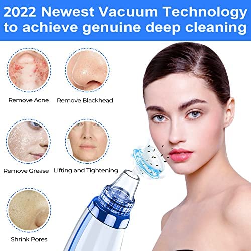 Blackhead Remover Pore Vacuum Upgraded Facial Cleaner Electric Acne Comedone Whitehead Extractor Tool-5 Suction Power 5 Probes Kit