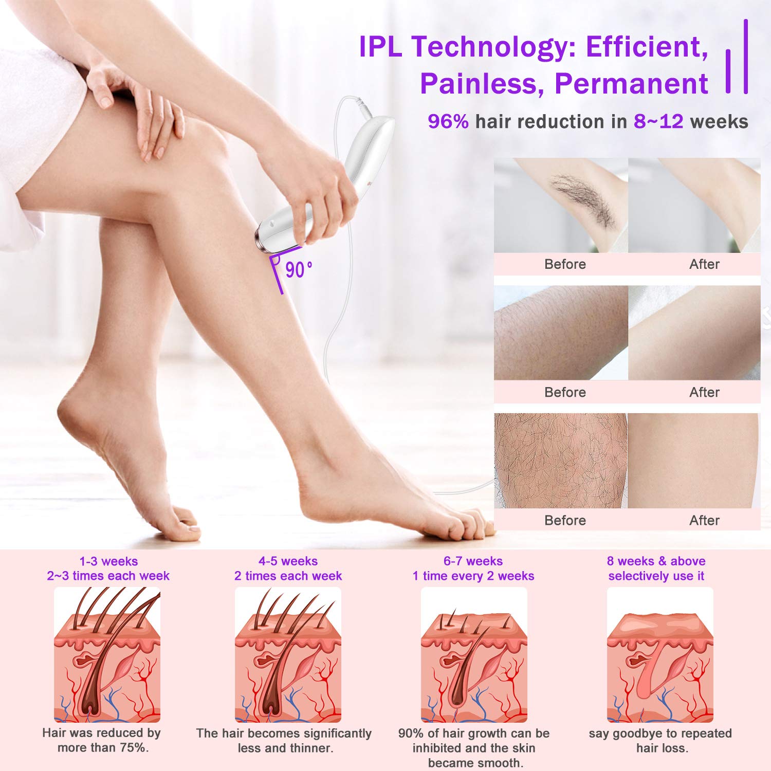 At-Home Hair Removal for Women & Men, Upgraded to 999,999 Flashes Laser Hair Removal, Permanent Painless Hair Removal Device for Facial Whole Body