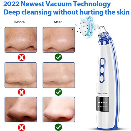 Blackhead Remover Pore Vacuum Upgraded Facial Cleaner Electric Acne Comedone Whitehead Extractor Tool-5 Suction Power 5 Probes Kit